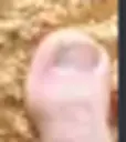 TOE